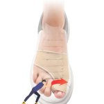 2Pcs Silicone Heel Pads - Image 4